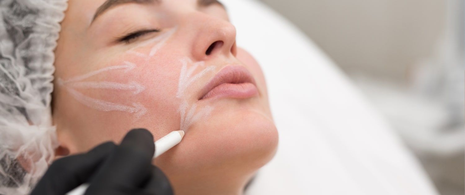 Liquid Facelift